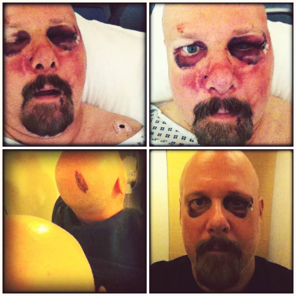 GARY MESKIL de PRO-PAIN agredido durante su gira por Europa